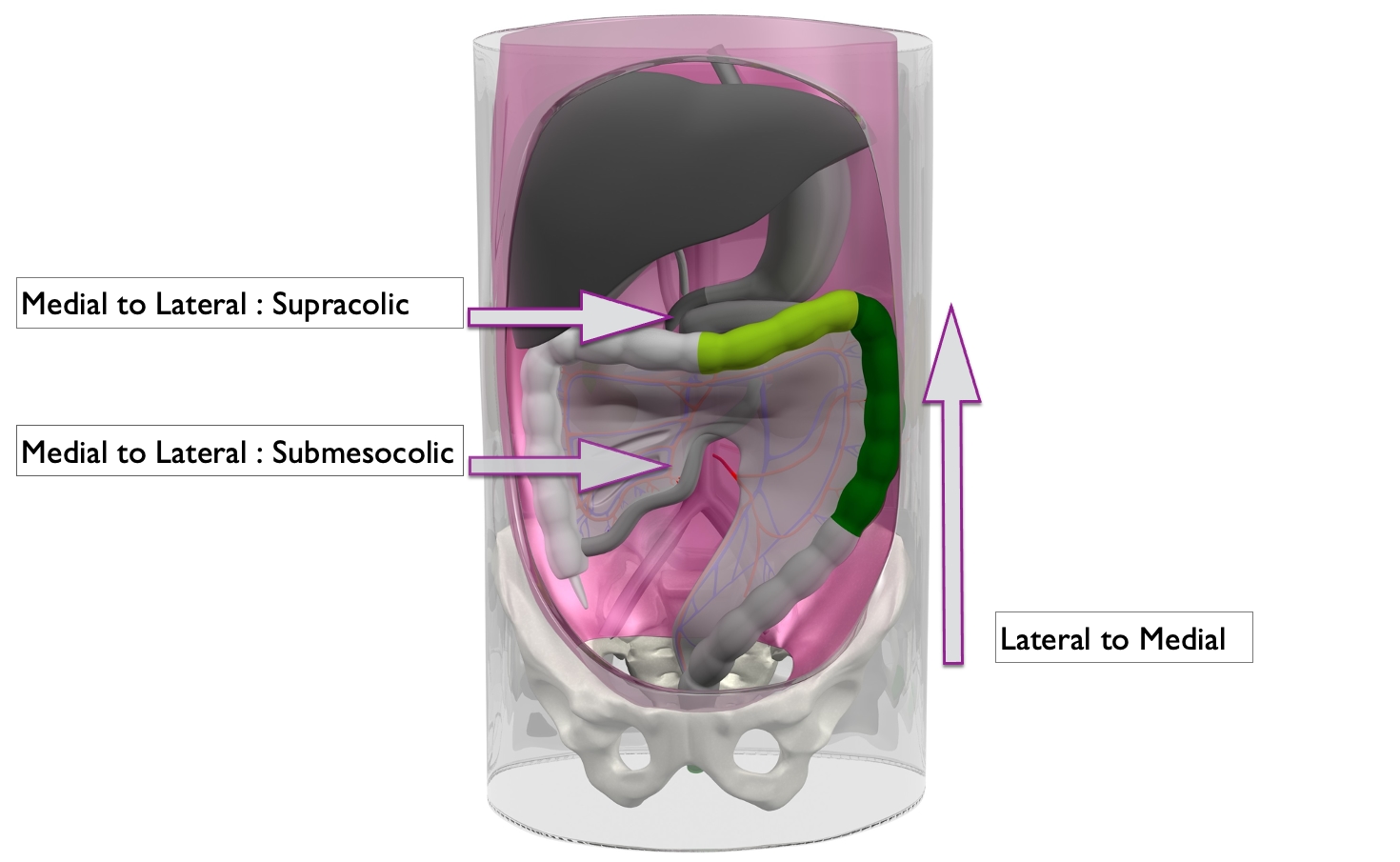 submesocolic approach