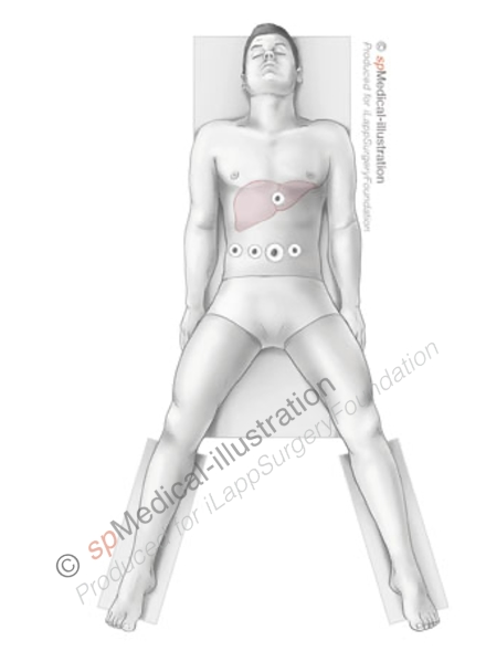 Introduction to Minor Hepatectomy