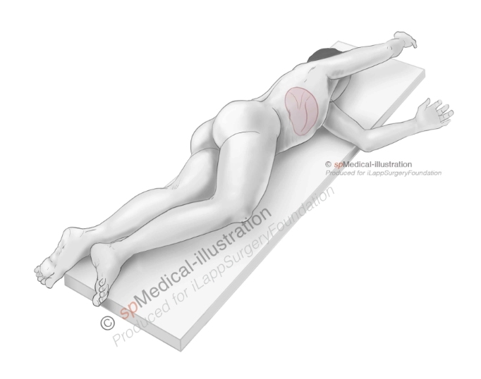 Semiprone position: step by step 