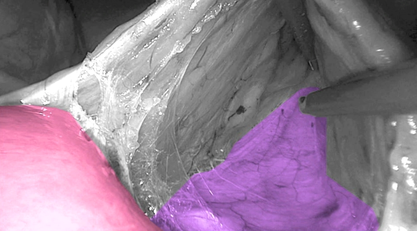 Standardized approach2