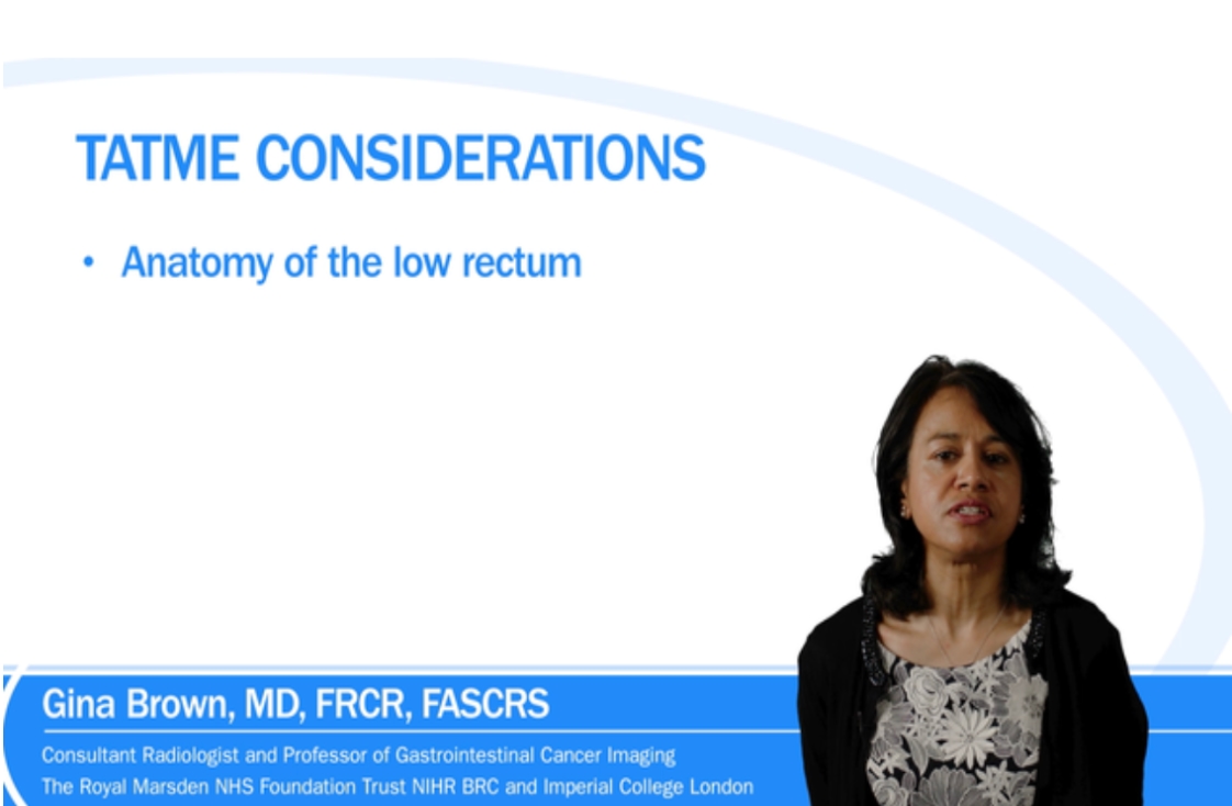 tatme considerations