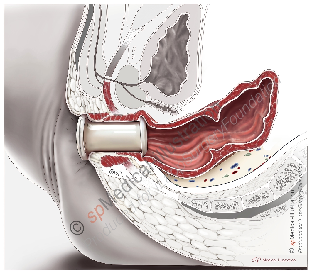 Installation of platform2