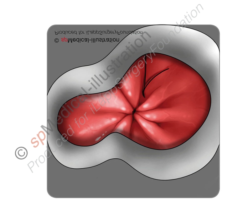 Perfect round shape of the access platform3