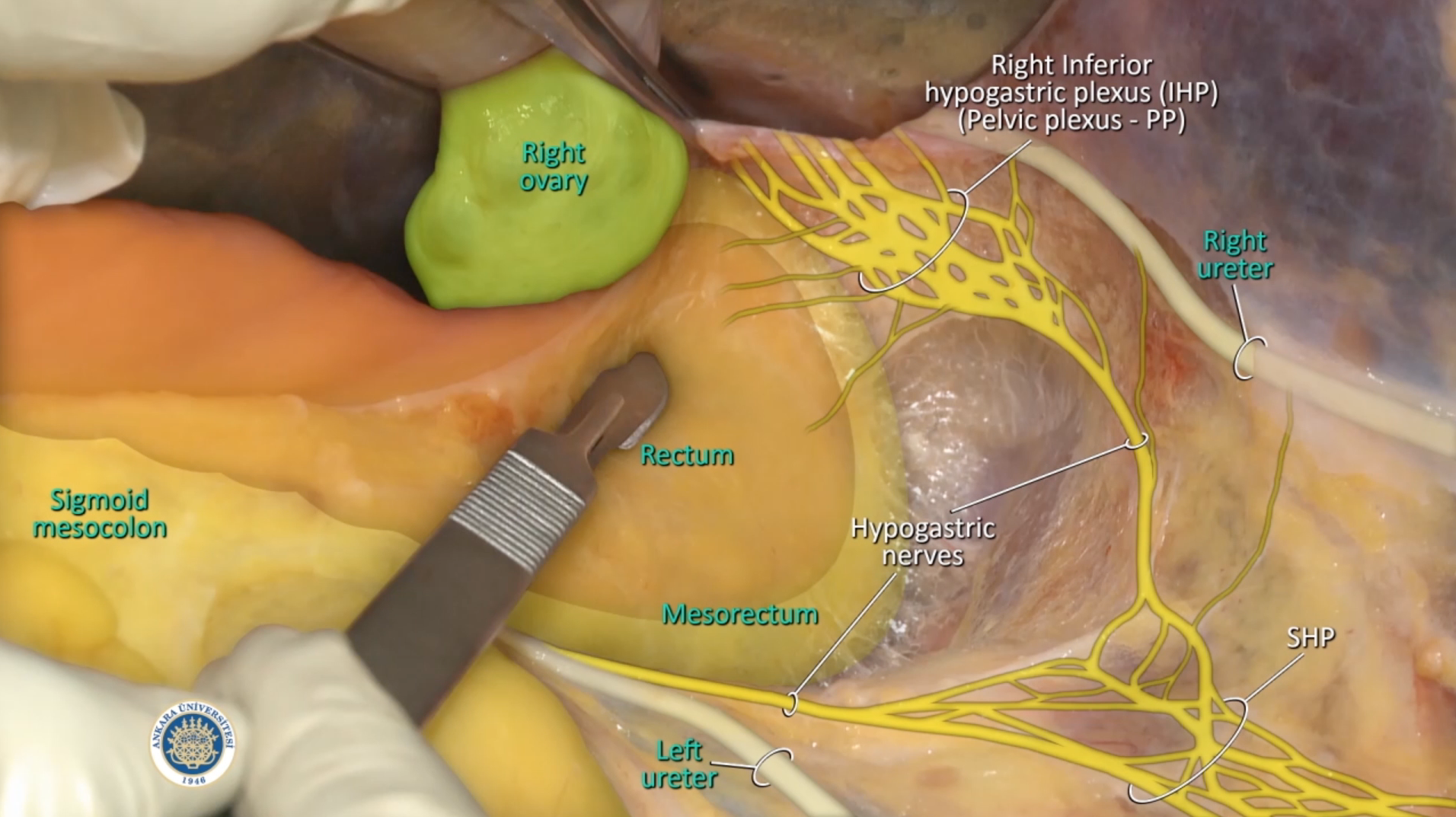 anatomy of the pelvis
