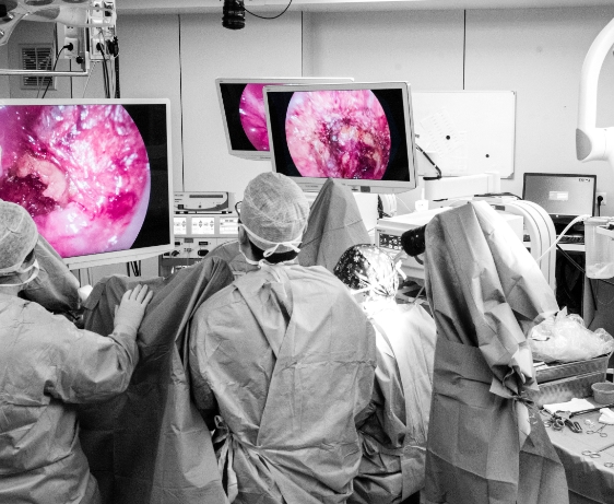 foto van operatie laparoscopy
